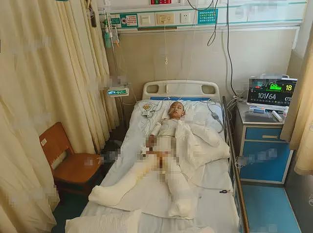 煤气爆炸后续！爸爸先跑，母女俩严重烧伤，治疗要100万，家属回应（视频/组图） - 8