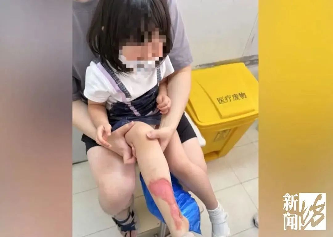 上海知名商场火锅店整壶滚烫高汤翻倒，祖孙二人严重烫伤崩溃（组图） - 3