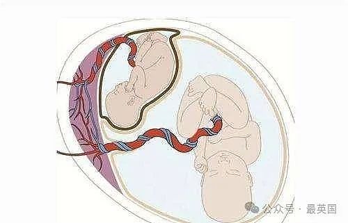 揭秘世界上唯一有四条腿的美女:家人靠她暴富,2个生殖系统交替生娃,死后竟遭神秘处理…(组图) - 4