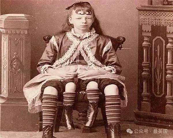 揭秘世界上唯一有四条腿的美女:家人靠她暴富,2个生殖系统交替生娃,死后竟遭神秘处理…(组图) - 7