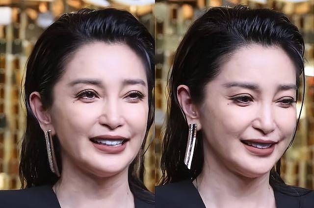51岁的李冰冰被曝取出假体、溶掉玻尿酸（组图） - 3