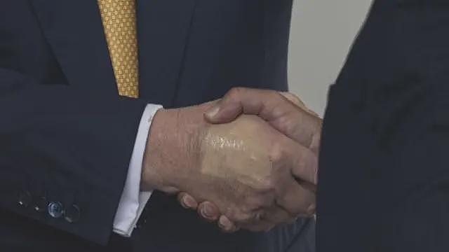 白宫表示，特朗普在被问及瘀伤后被诊断出患有静脉疾病（组图） - 2