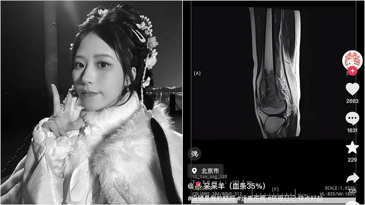 抗癌网红“呆呆羊”离世年仅22岁，告别信：替我多看看灿烂的晚霞（组图） - 1