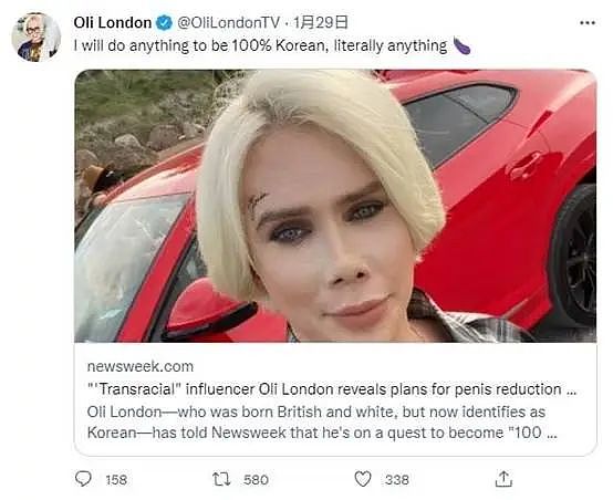 为变韩国人，英国网红专门做DD缩小手术，还变性了？现在，他又想变回来了...（组图） - 5