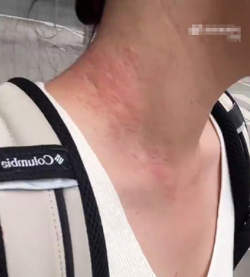【爆笑】在医院检查出雌雄同体后,被全网心疼了?一开始只关心生理结构,下一秒:这得绝育2次...(组图) - 23