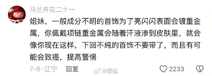 【爆笑】在医院检查出雌雄同体后,被全网心疼了?一开始只关心生理结构,下一秒:这得绝育2次...(组图) - 34