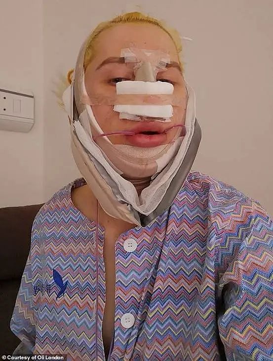 为变韩国人，英国网红专门做DD缩小手术，还变性了？现在，他又想变回来了...（组图） - 8