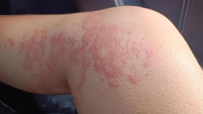 央视曝光“毒手机壳”！会基因突变，致癌率极高，家里有的快丢掉（组图） - 19