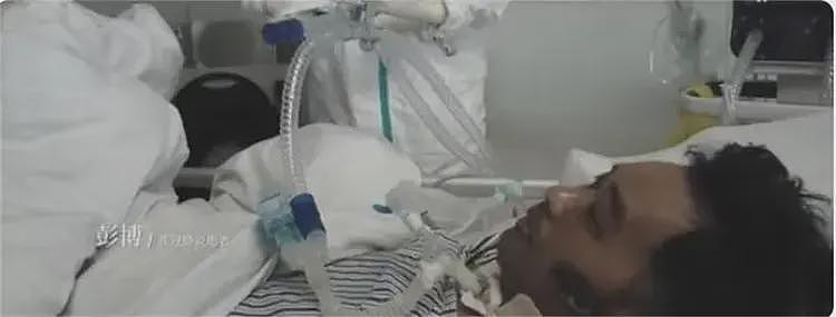全身溃烂生不如死,暴瘦40斤,武汉首批新冠患者如今过得如何?(组图) - 11