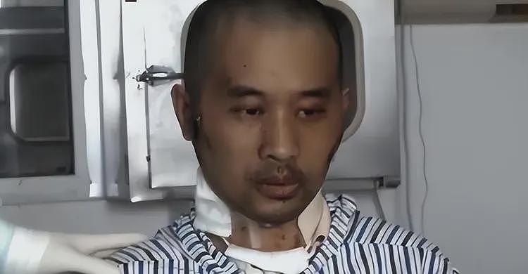全身溃烂生不如死,暴瘦40斤,武汉首批新冠患者如今过得如何?(组图) - 17