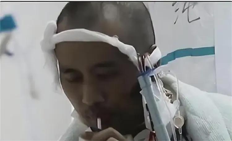 全身溃烂生不如死,暴瘦40斤,武汉首批新冠患者如今过得如何?(组图) - 9