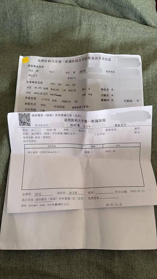 游客在大理“跳火把”面部被烧伤，有人往火里撒松香助燃（组图） - 2