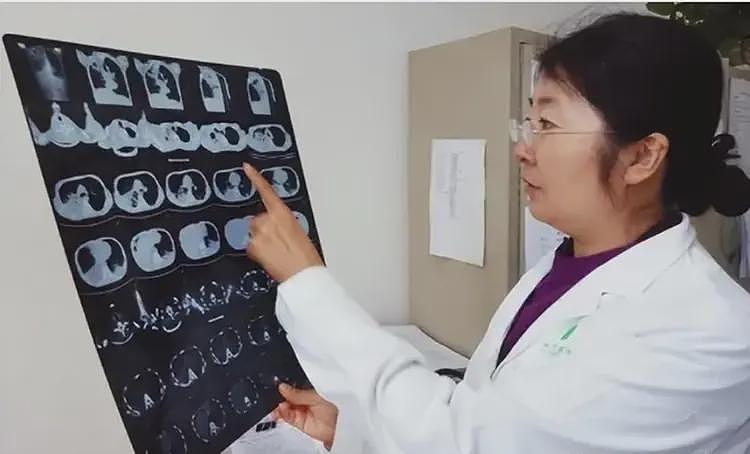 全身溃烂生不如死,暴瘦40斤,武汉首批新冠患者如今过得如何?(组图) - 10