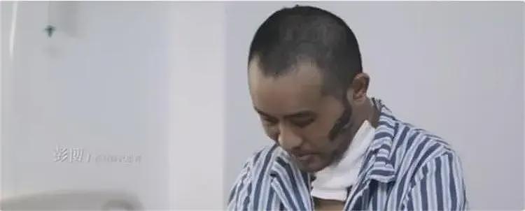 全身溃烂生不如死,暴瘦40斤,武汉首批新冠患者如今过得如何?(组图) - 16