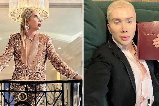 为变成韩国人，英国男子疯狂整容，做丁丁缩小技术甚至变成女人！如今，他却想变回最初...（组图） - 16