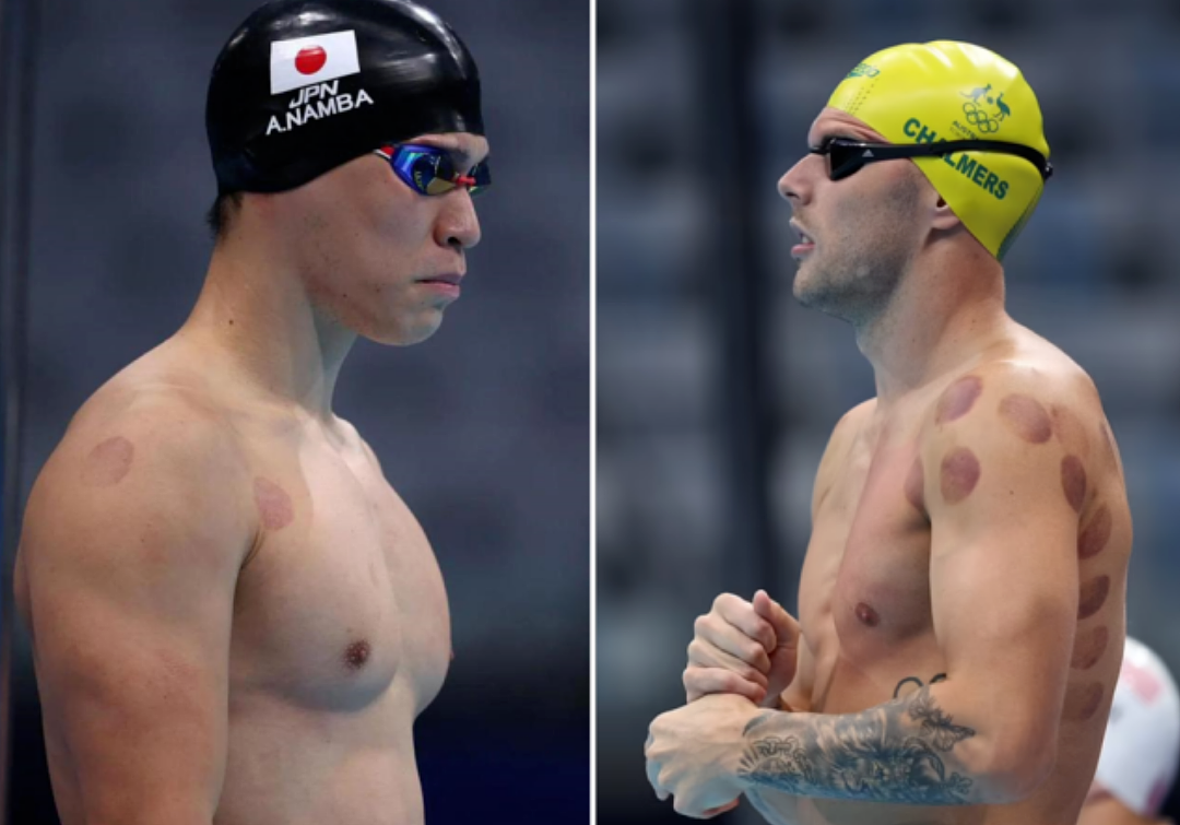 笑不活了！拜佛、拔罐、保温杯…各国运动员集体迷信东方玄学（组图） - 17