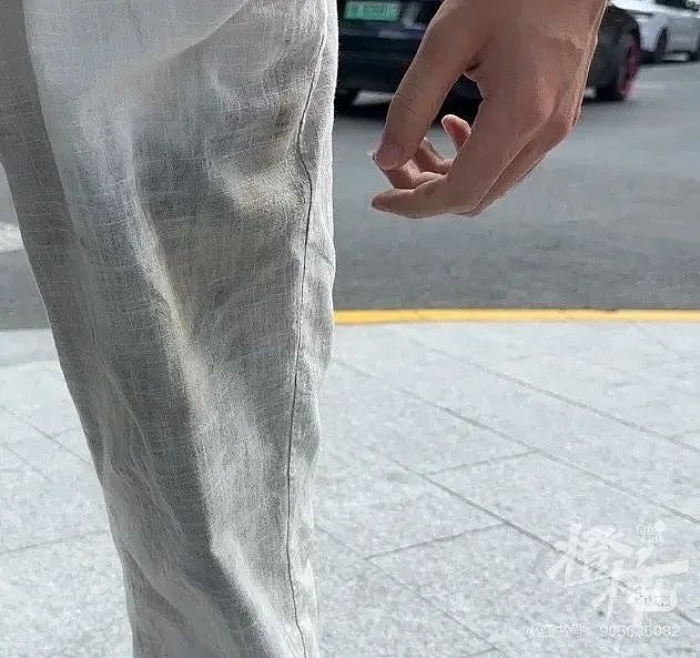 上海一商场门口,男子口袋里的东西突然起火,致三级烧伤!国家正在严查(组图) - 4