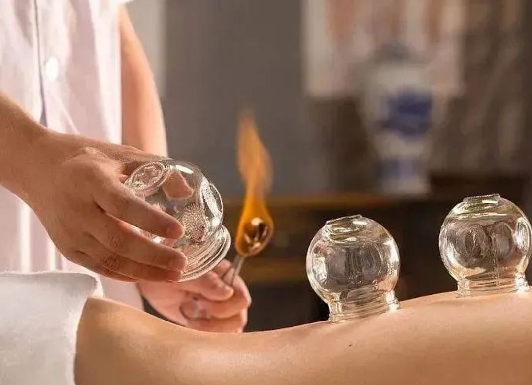 笑不活了！拜佛、拔罐、保温杯…各国运动员集体迷信东方玄学（组图） - 14