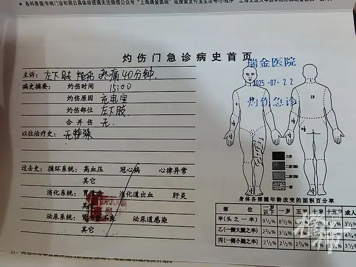 上海一商场门口,男子口袋里的东西突然起火,致三级烧伤!国家正在严查(组图) - 3
