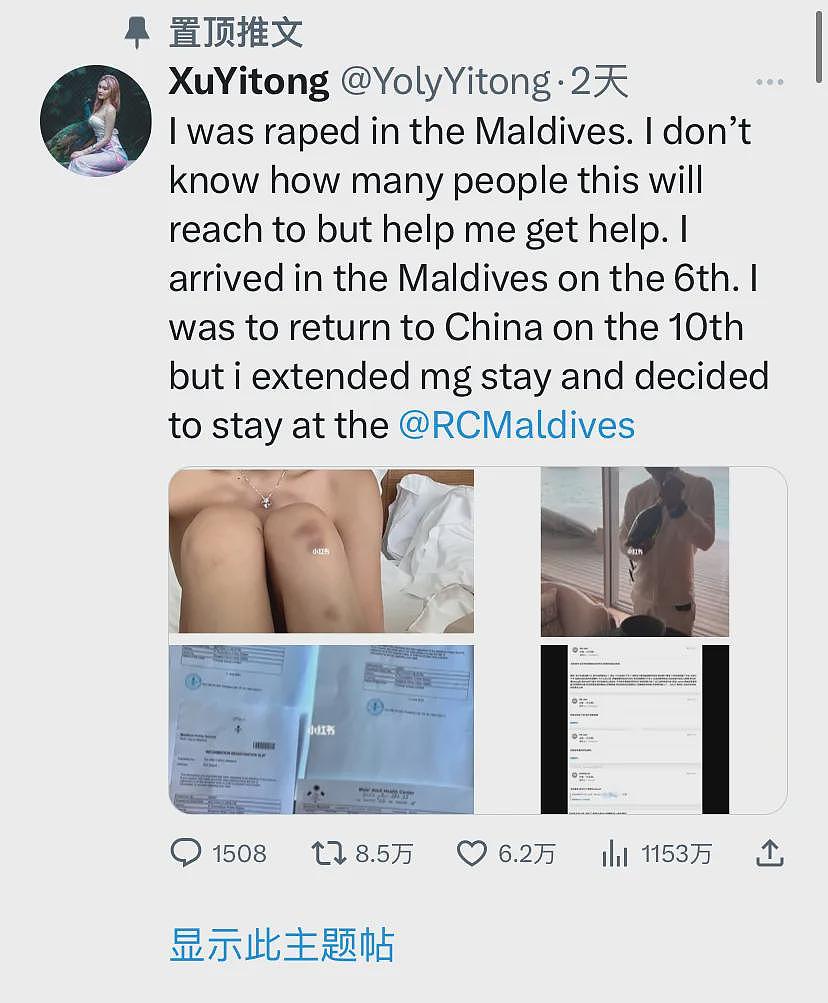 “证据不足”，澳洲名校中国女留学生旅游时在超豪华酒店遭性侵，案子被驳回，她患上了急性应激障碍（组图） - 5