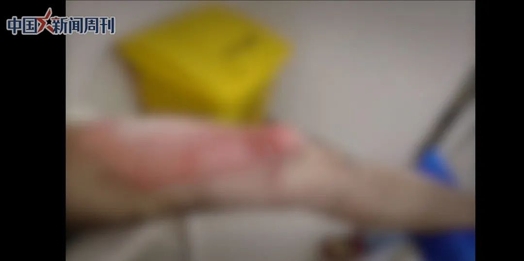 上海一商场门口,男子口袋里的东西突然起火,致三级烧伤!国家正在严查(组图) - 2