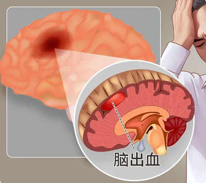 惊!一年吃掉1500亿片,多人吃进ICU(组图) - 3