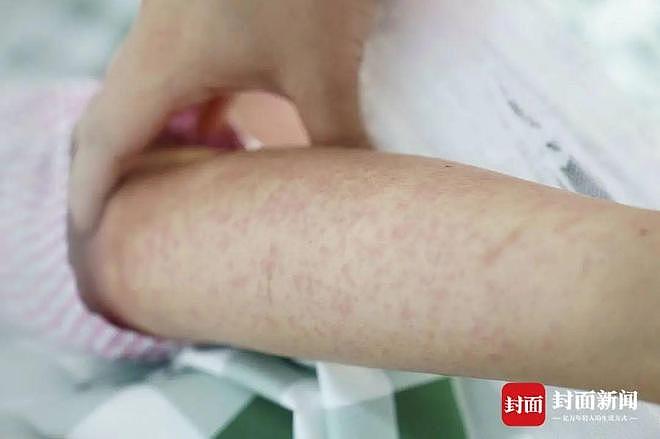 确诊超3000例！探访基孔肯雅热定点医院：患者称疼得“无法下地行走”（组图） - 6