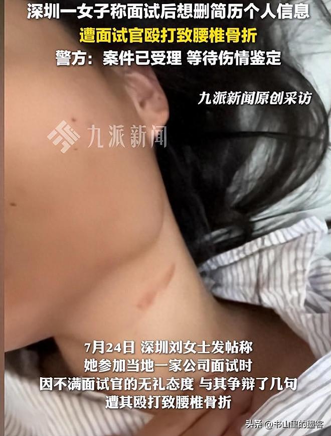 深圳26岁女子面试后被殴骨折，警方介入！更多黑料扒出（组图） - 1