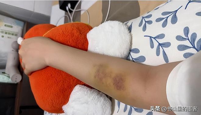 深圳26岁女子面试后被殴骨折，警方介入！更多黑料扒出（组图） - 17