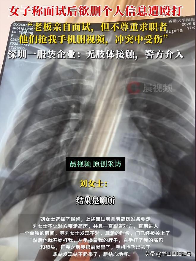 深圳26岁女子面试后被殴骨折，警方介入！更多黑料扒出（组图） - 3
