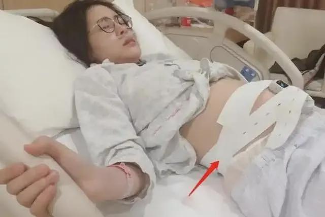“去父留子”的张碧晨:7年前管不住下半身,如今她后悔了吗? (组图) - 23