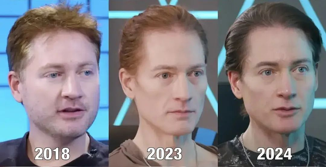 好莱坞知名男星为永葆青春全身大换血?称延长寿命还能重返神颜,专家:笑死,专坑有钱的傻蛋...(组图) - 10
