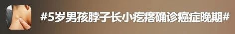 5岁男孩确诊癌症晚期!别忽视身上这种“小疙瘩”,很多人都有(组图) - 2