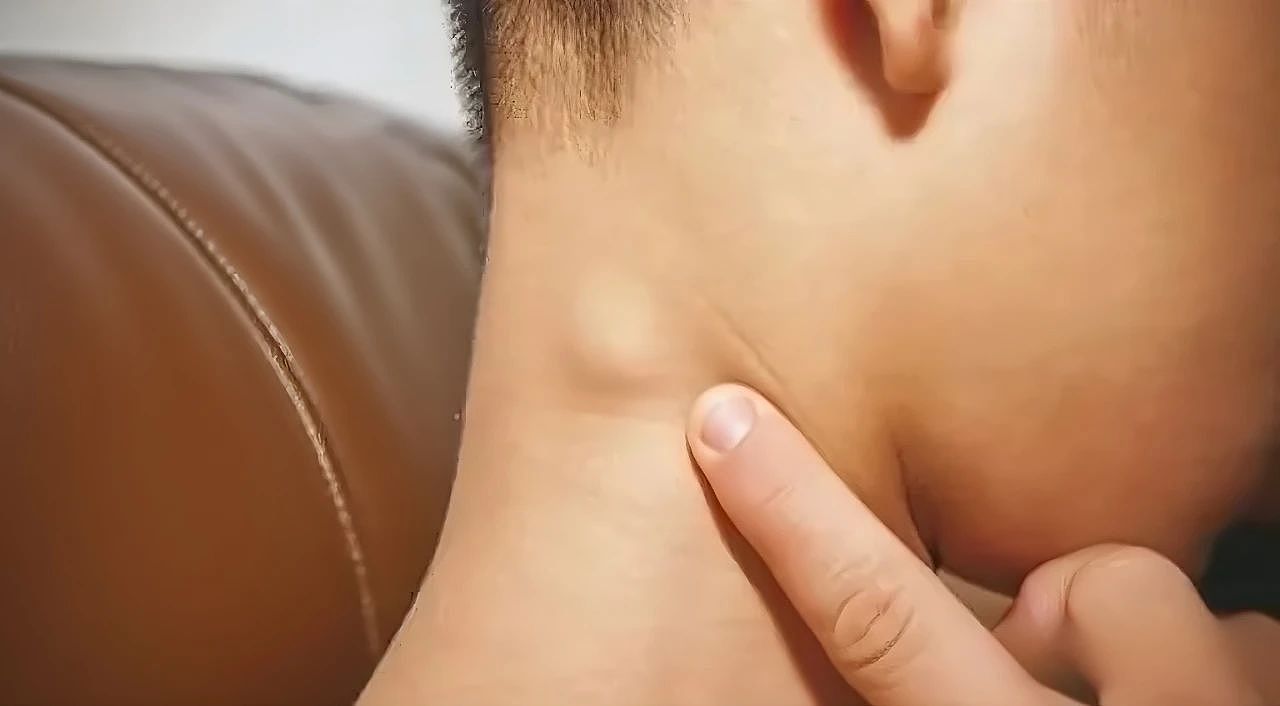 5岁男孩确诊癌症晚期!别忽视身上这种“小疙瘩”,很多人都有(组图) - 1