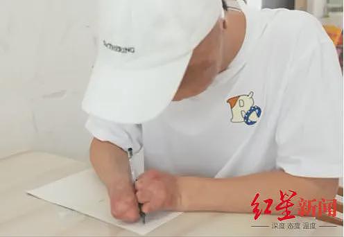 “烧伤男孩“664分被东南大学录取:曾经历23次手术(组图) - 2