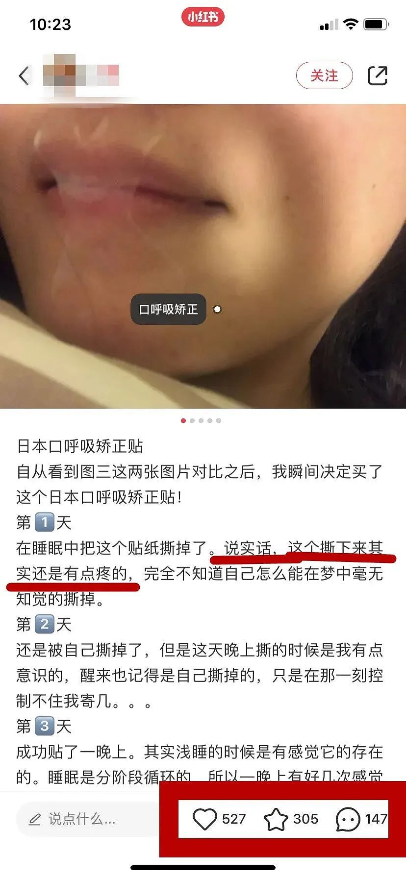 悉尼北区幼儿园出事了！幼童被胶带封嘴“练习呼吸”，官方监管机构介入...（组图） - 9