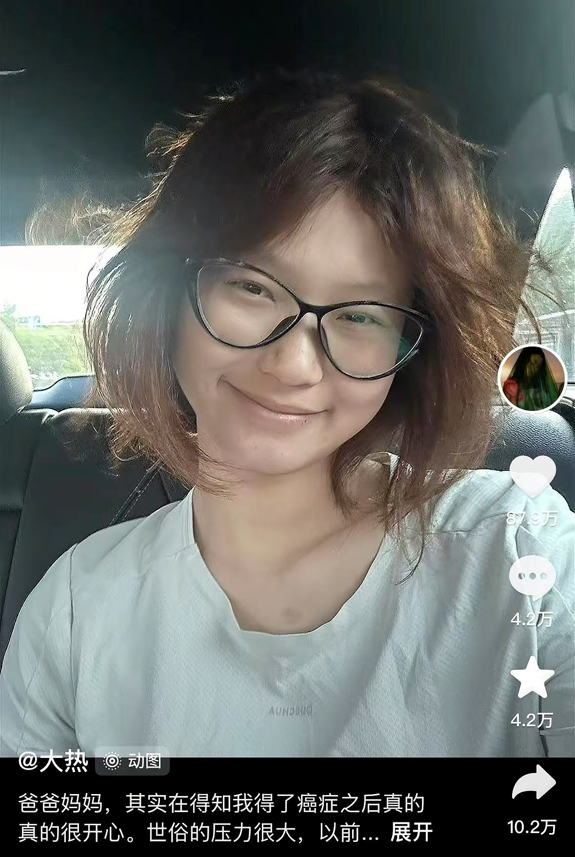 那些确诊癌症的年轻人：我反而觉得轻松了（组图） - 4