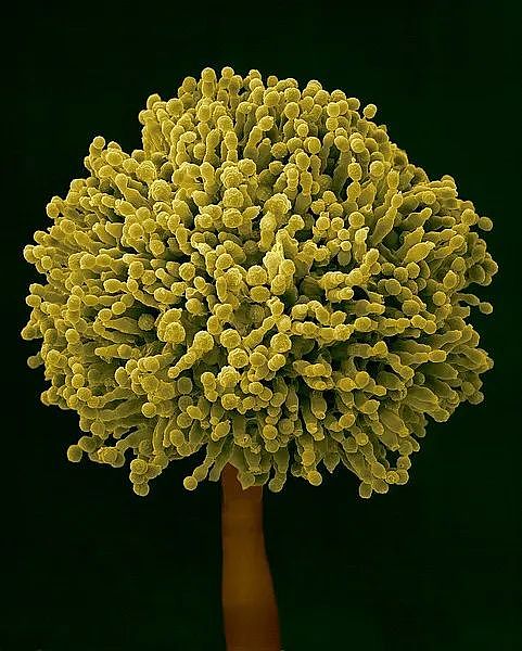 女子肚里发现大量霉菌！这习惯很多家庭都有，严重的1毫克就可能致癌…（组图） - 5