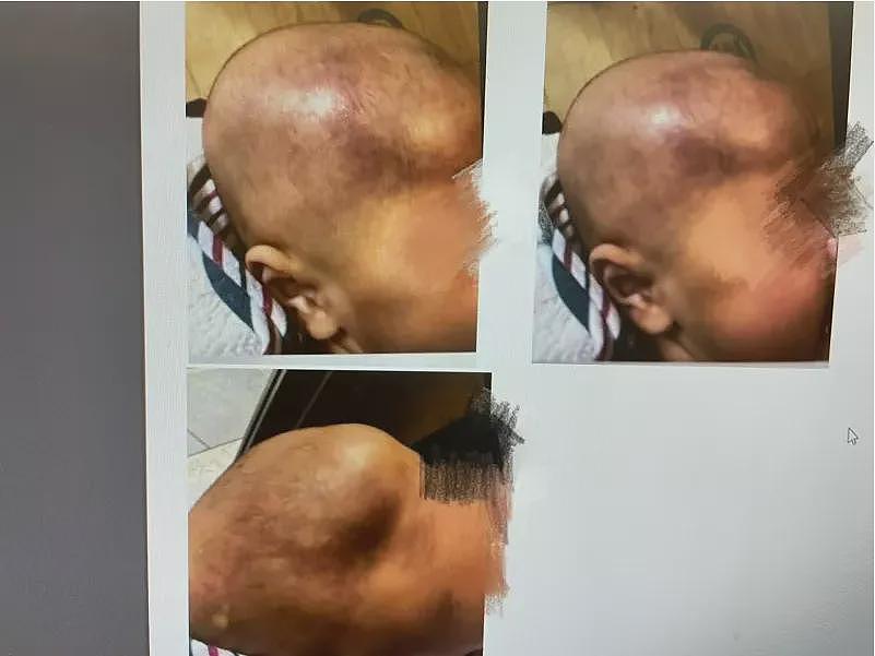 南加豪宅21幼童遭虐，照片触目惊心，男婴颅脑重伤（组图） - 3
