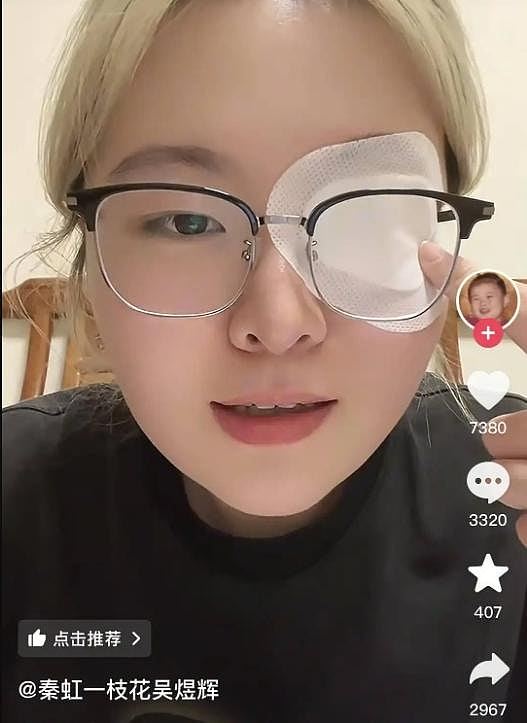 发病率仅0.03%!中国知名童星患罕见“美女病”,叹25岁右眼已失明(组图) - 2