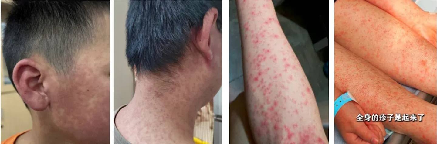佛山防疫工作署：买47种药须实名登记，包括连花清瘟、布洛芬等（组图） - 6