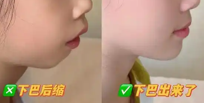 田亮17岁女儿森碟近照曝光！矫正后颜值大变，原来这一细节不重视，孩子真会变丑...（组图） - 8