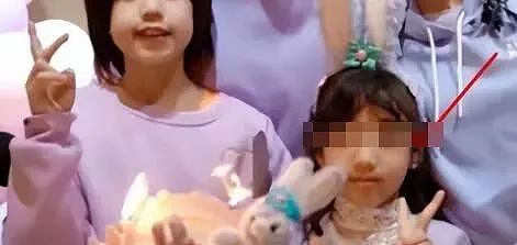 田亮17岁女儿森碟近照曝光！矫正后颜值大变，原来这一细节不重视，孩子真会变丑...（组图） - 10