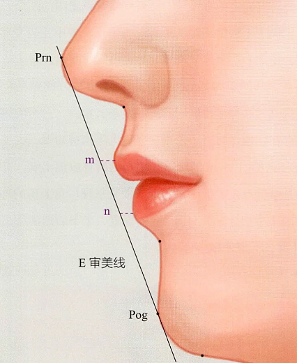 田亮17岁女儿森碟近照曝光！矫正后颜值大变，原来这一细节不重视，孩子真会变丑...（组图） - 13