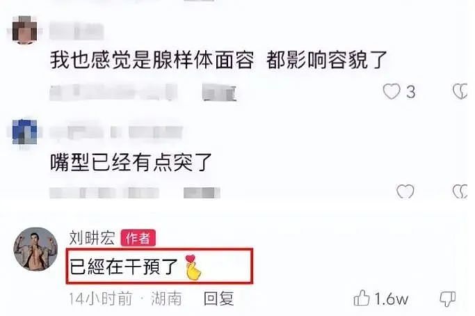 田亮17岁女儿森碟近照曝光！矫正后颜值大变，原来这一细节不重视，孩子真会变丑...（组图） - 11