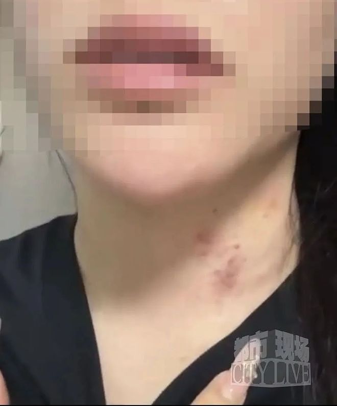 29岁女子疑被男友施暴后从25楼跳下，男友从事放贷行业（组图） - 4