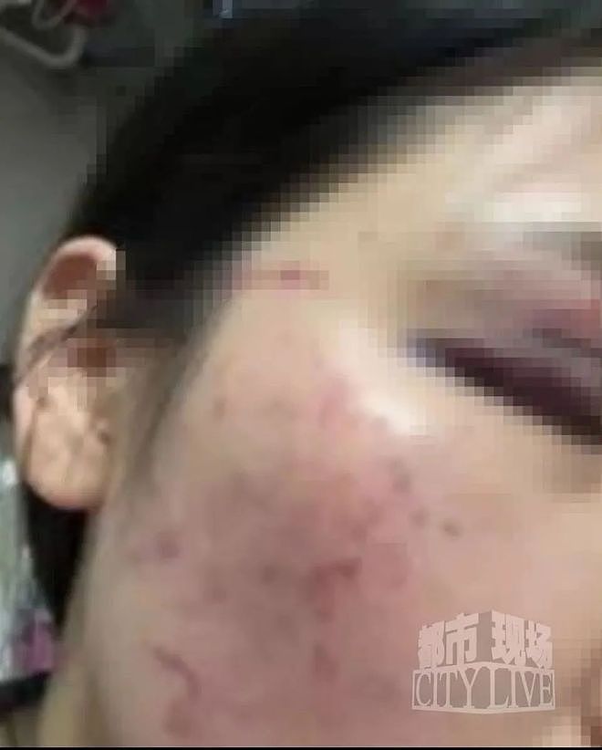 29岁女子疑被男友施暴后从25楼跳下，男友从事放贷行业（组图） - 5