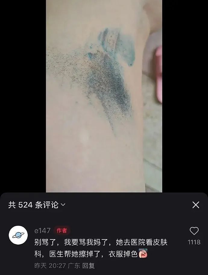 【爆笑】千万不要和隆过鼻的男生谈恋爱？哈哈哈太抽象了吧？（组图） - 43