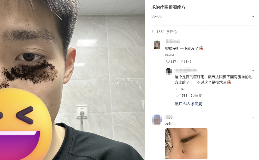 云南白药湿敷黑眼圈替代海蓝之谜？不想被贵妇眼霜收割的熬夜打工人，都在玩“邪修”（组图） - 19