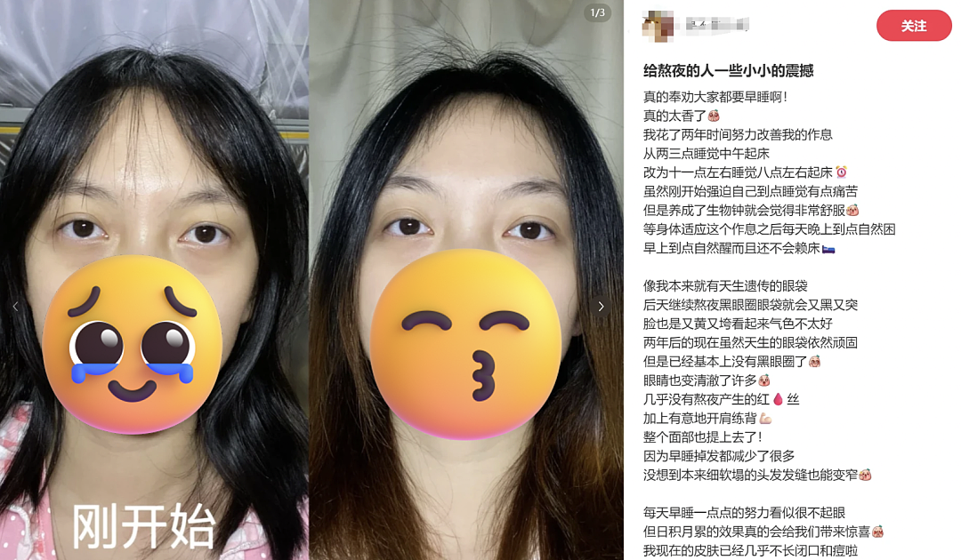 云南白药湿敷黑眼圈替代海蓝之谜？不想被贵妇眼霜收割的熬夜打工人，都在玩“邪修”（组图） - 12
